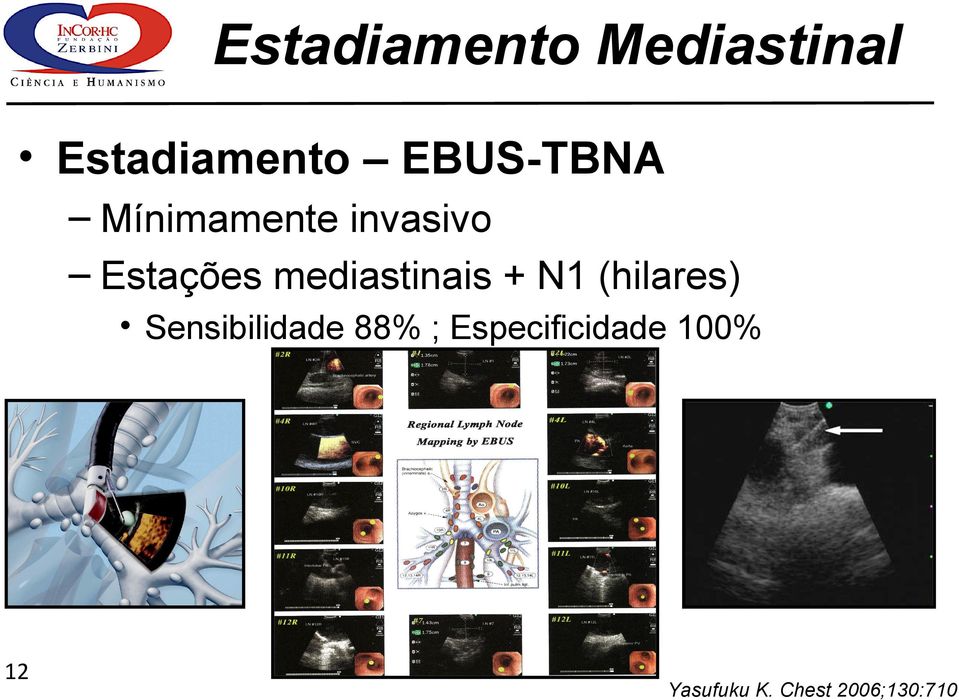 (hilares) Sensibilidade 88% ;