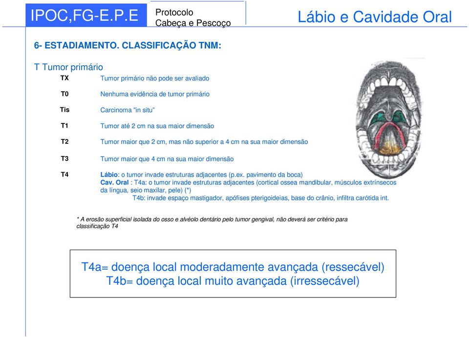 que 2 cm, mas não superior a 4 cm na sua maior dimensão Tumor maior que 4 cm na sua maior dimensão Lábio: o tumor invade estruturas adjacentes (p.ex. pavimento da boca) Cav.