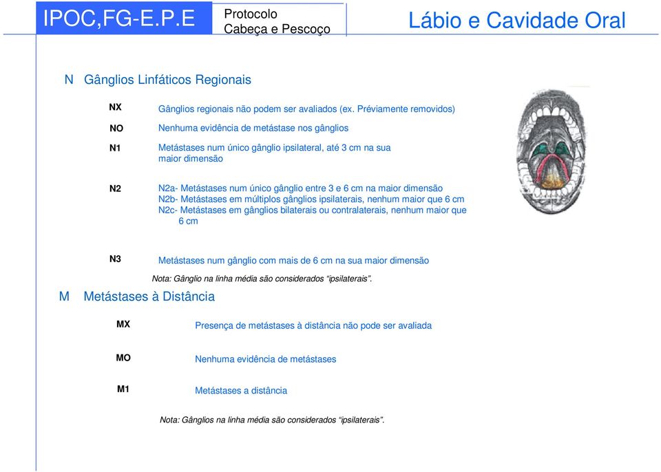 maior dimensão N2b- Metástases em múltiplos gânglios ipsilaterais, nenhum maior que 6 cm N2c- Metástases em gânglios bilaterais ou contralaterais, nenhum maior que 6 cm N3 Metástases num gânglio com