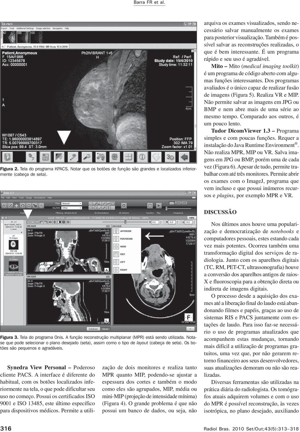 É um programa rápido e seu uso é agradável. Mito Mito (medical imaging toolkit) é um programa de código aberto com algumas funções interessantes.