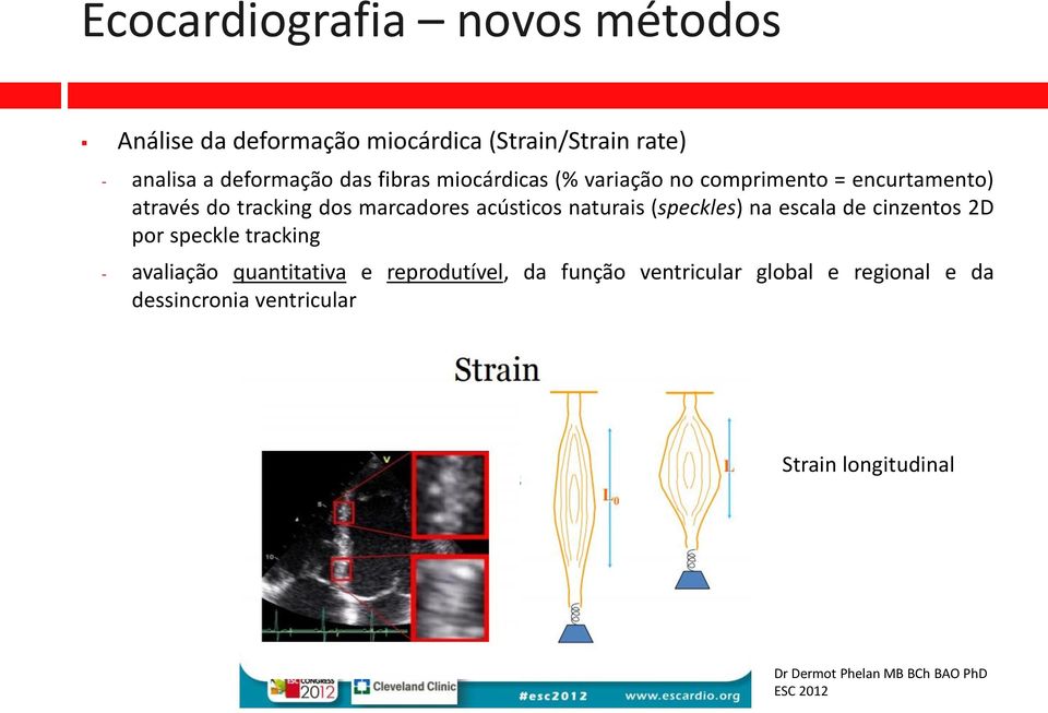 naturais (speckles) na escala de cinzentos 2D por speckle tracking - avaliação quantitativa e reprodutível, da