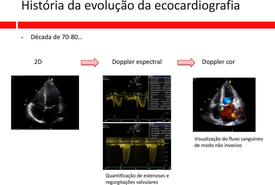 Visualização do fluxo sanguíneo de modo não