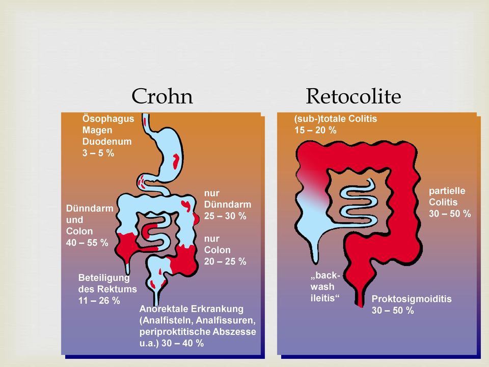 Rektums 11 26 % Anorektale Erkrankung (Analfisteln, Analfissuren, periproktitische