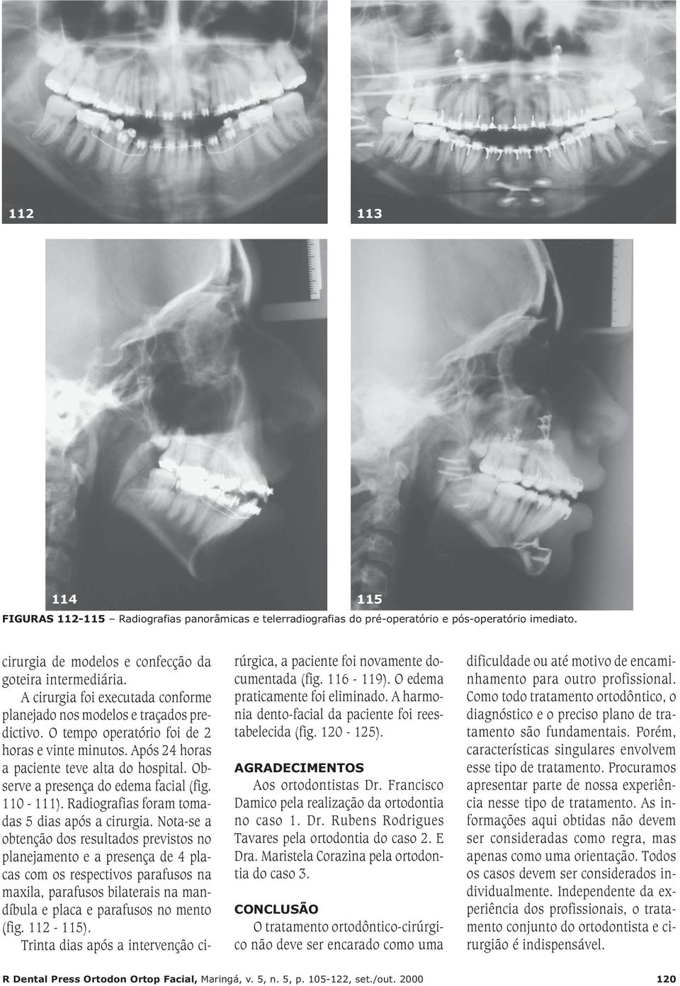 Observe a presença do edema facial (fig. 110-111). Radiografias foram tomadas 5 dias após a cirurgia.