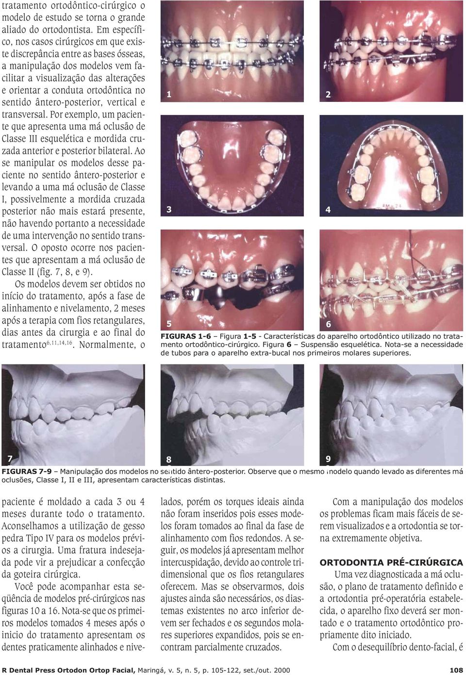 ântero-posterior, vertical e transversal. Por exemplo, um paciente que apresenta uma má oclusão de Classe III esquelética e mordida cruzada anterior e posterior bilateral.