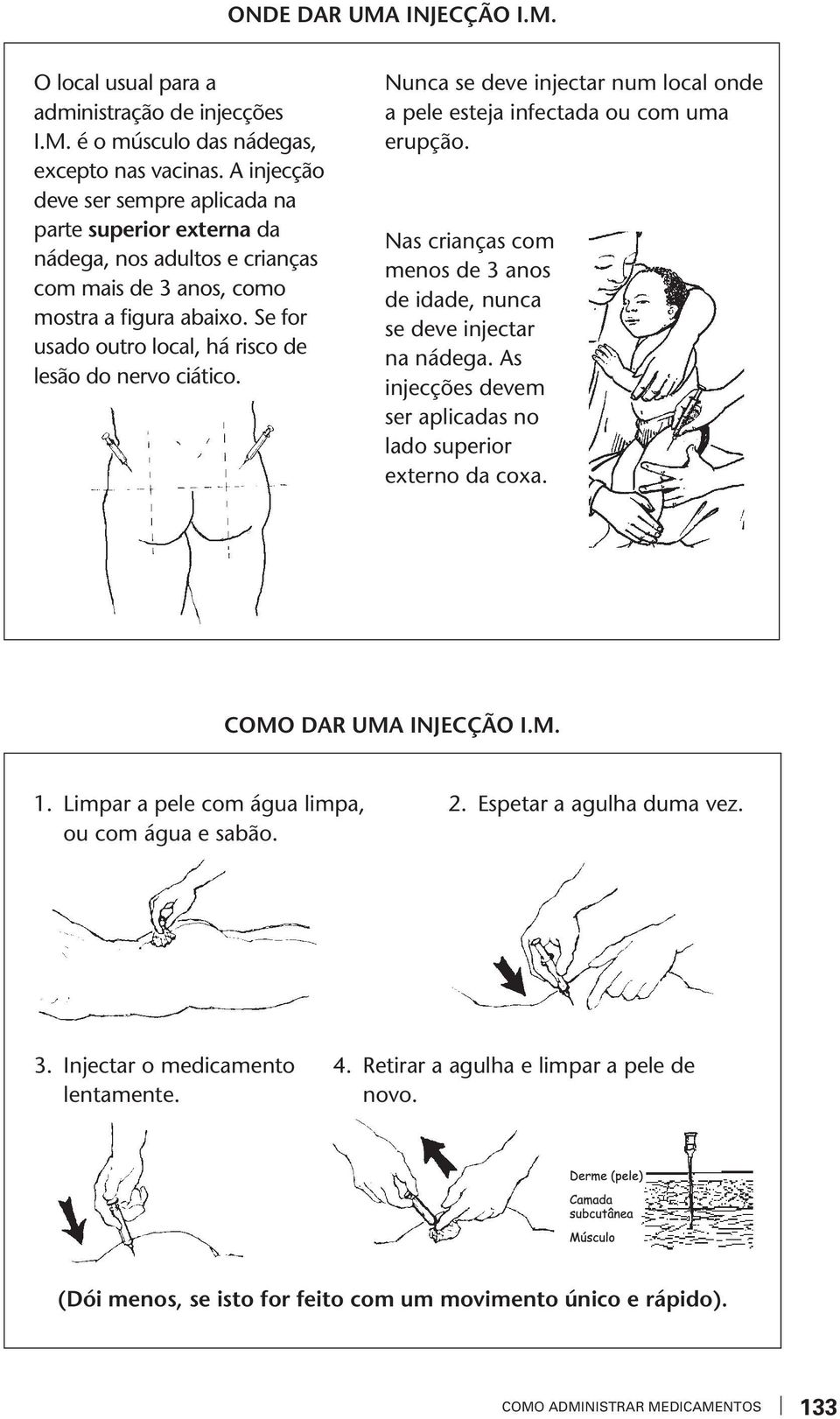 Se for usado outro local, há risco de lesão do nero ciático. Nunca se dee injectar num local onde a pele esteja infectada ou com uma erupção.