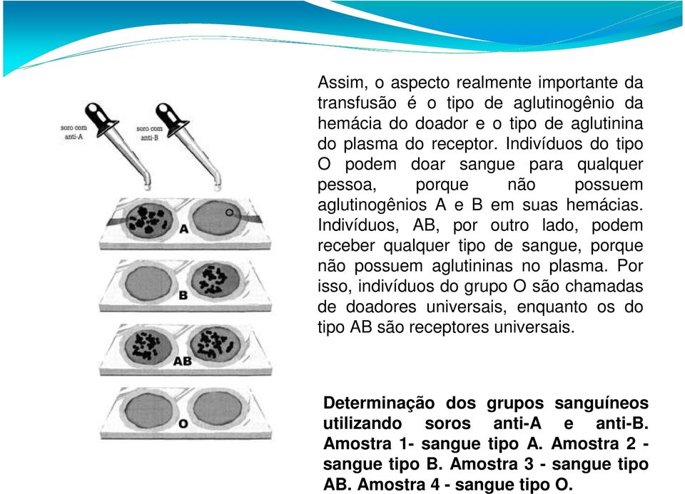 Indivíduos, AB, por outro lado, podem receber qualquer tipo de sangue, porque não possuem aglutininas no plasma.