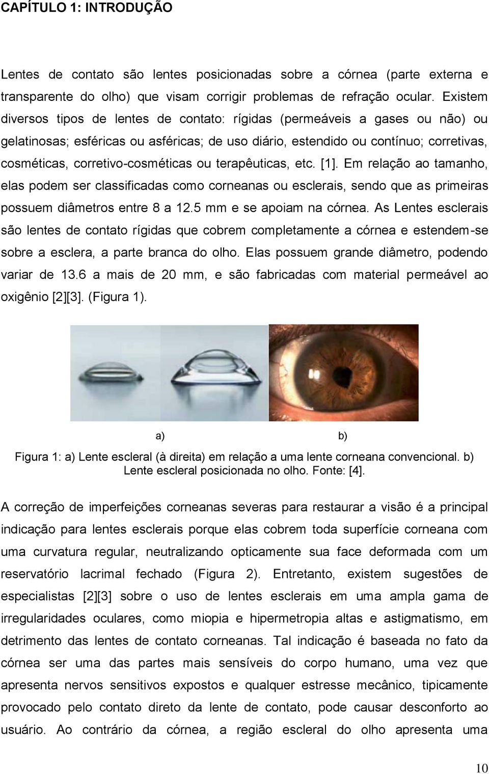 corretivo-cosméticas ou terapêuticas, etc. [1]. Em relação ao tamanho, elas podem ser classificadas como corneanas ou esclerais, sendo que as primeiras possuem diâmetros entre 8 a 12.