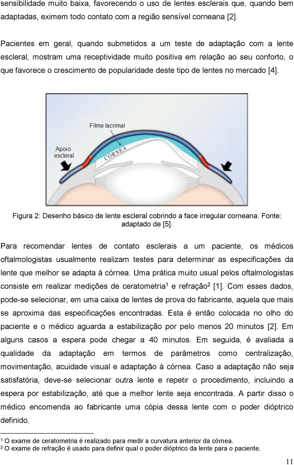 deste tipo de lentes no mercado [4]. Figura 2: Desenho básico de lente escleral cobrindo a face irregular corneana. Fonte: adaptado de [5].