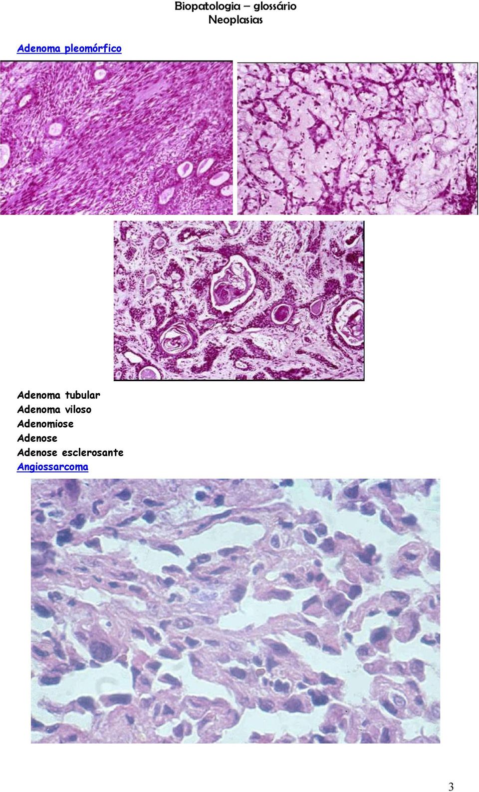 viloso Adenomiose Adenose