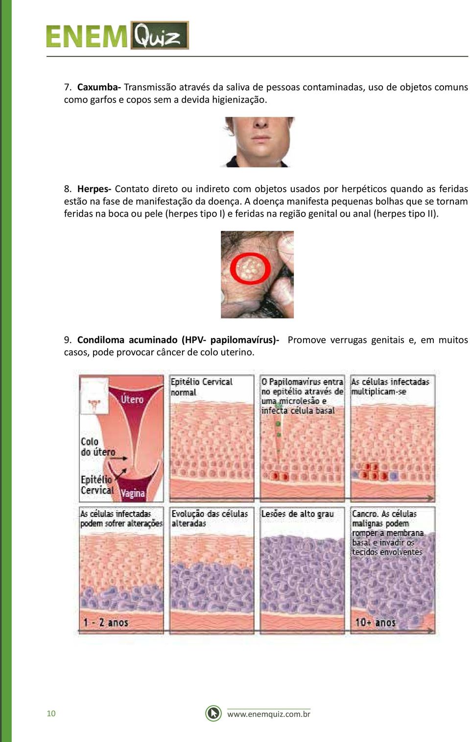A doença manifesta pequenas bolhas que se tornam feridas na boca ou pele (herpes tipo I) e feridas na região genital ou anal (herpes tipo
