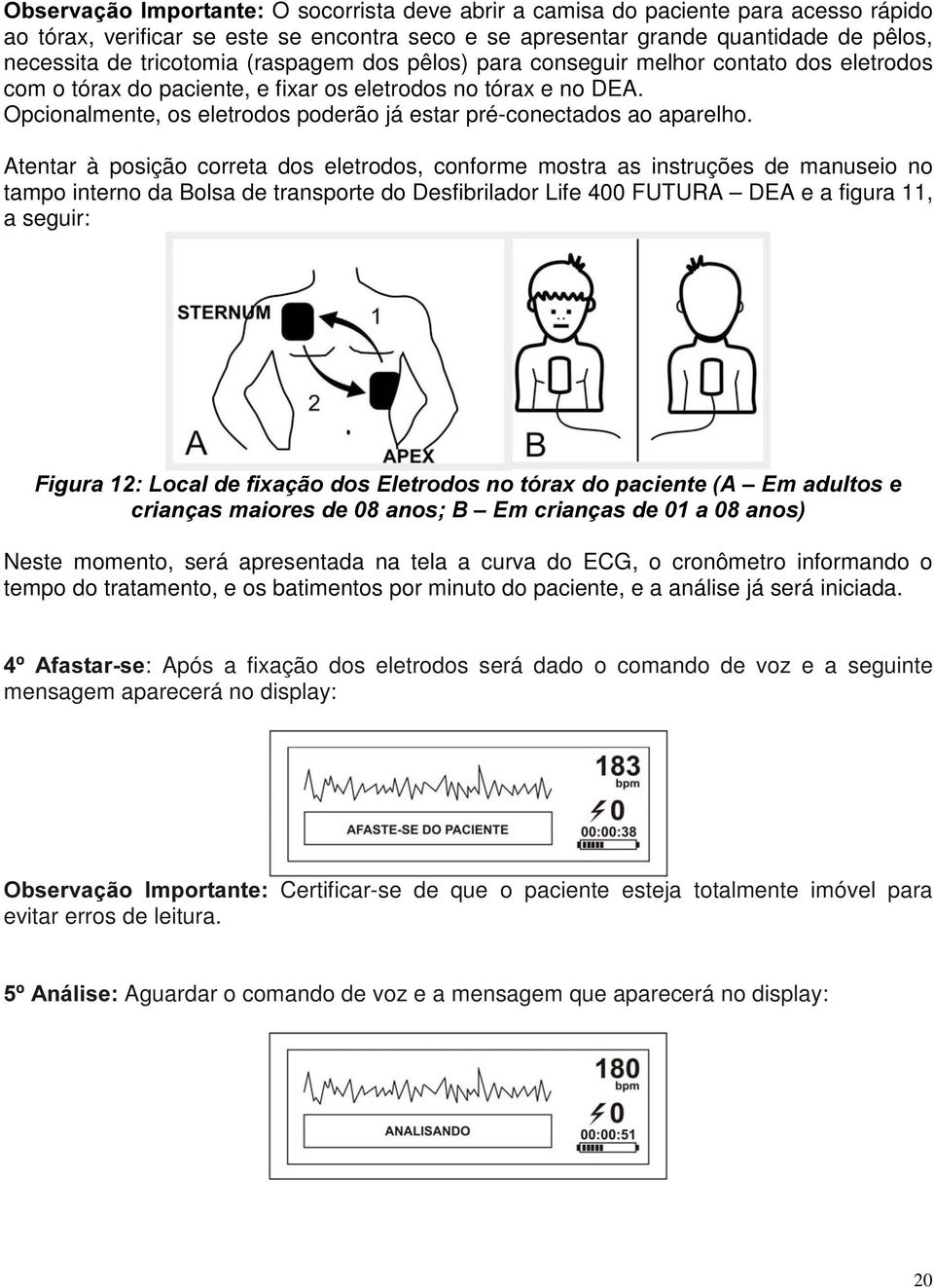 Opcionalmente, os eletrodos poderão já estar pré-conectados ao aparelho.