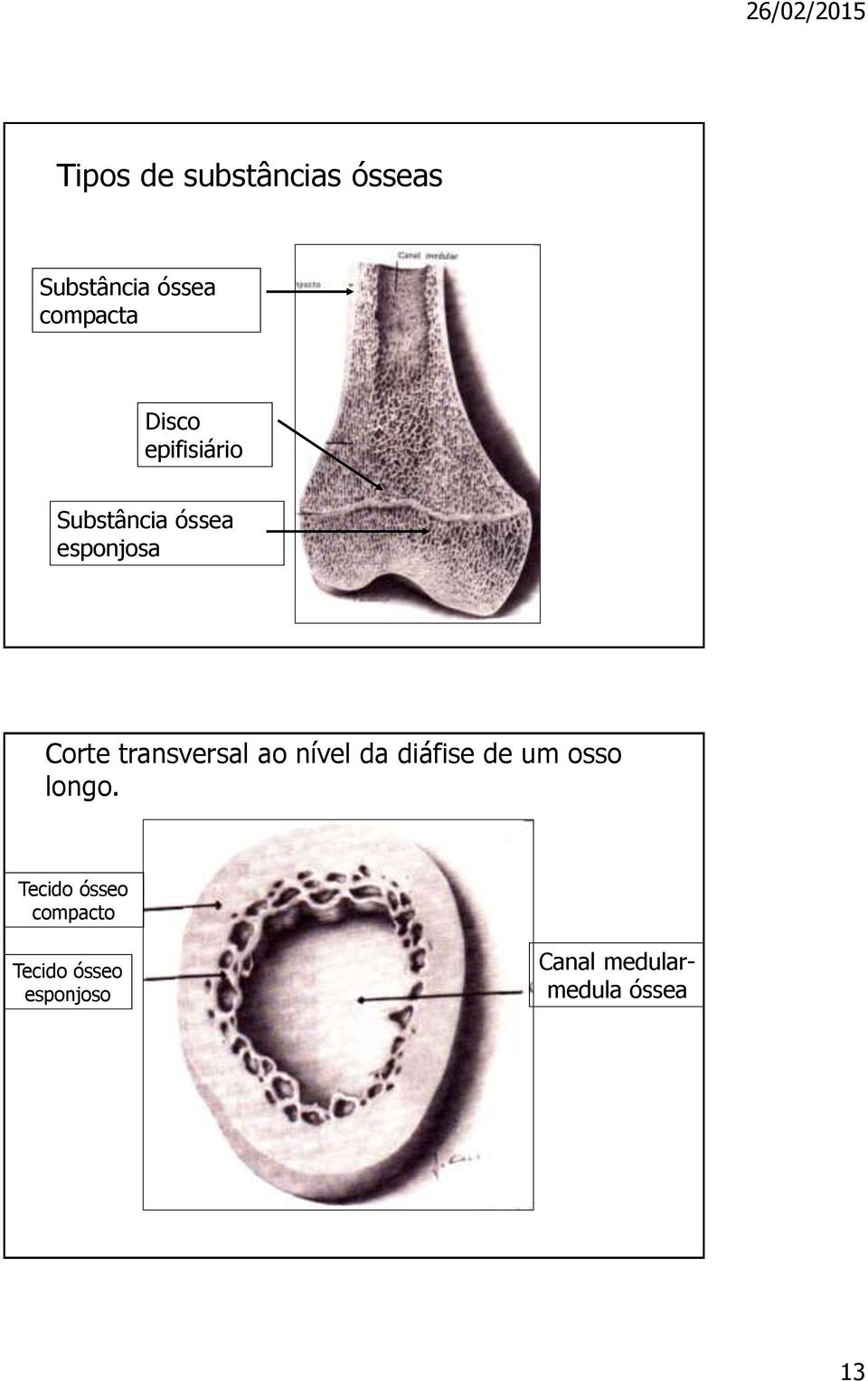 transversal ao nível da diáfise de um osso longo.