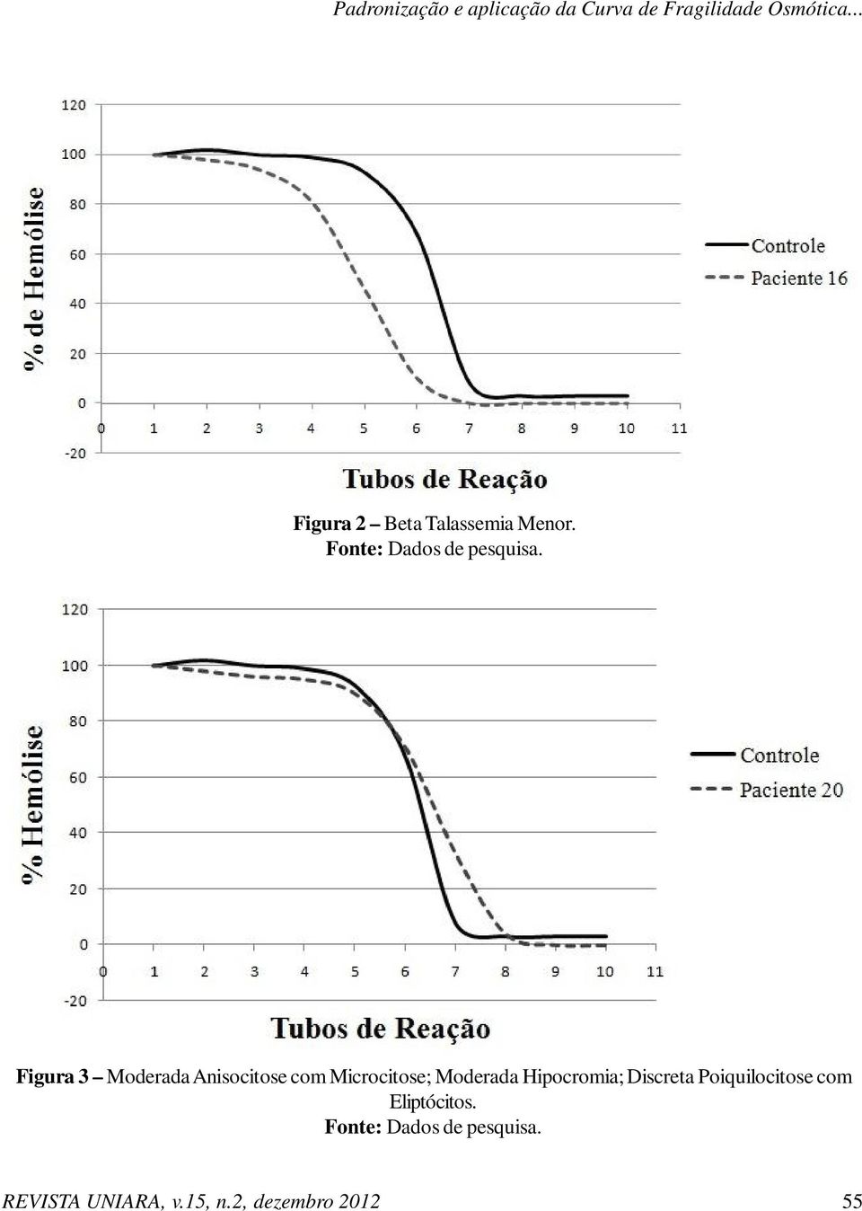 Figura 3 Moderada Anisocitose com Microcitose; Moderada