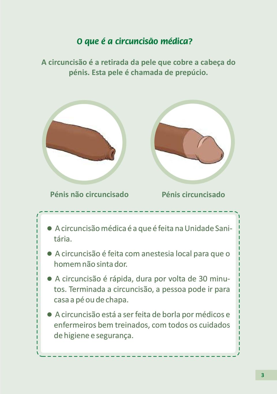 la circuncisão é feita com anestesia local para que o homem não sinta dor. la circuncisão é rápida, dura por volta de 30 minutos.