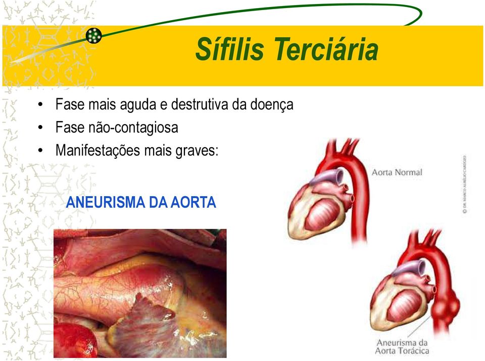 Fase não-contagiosa