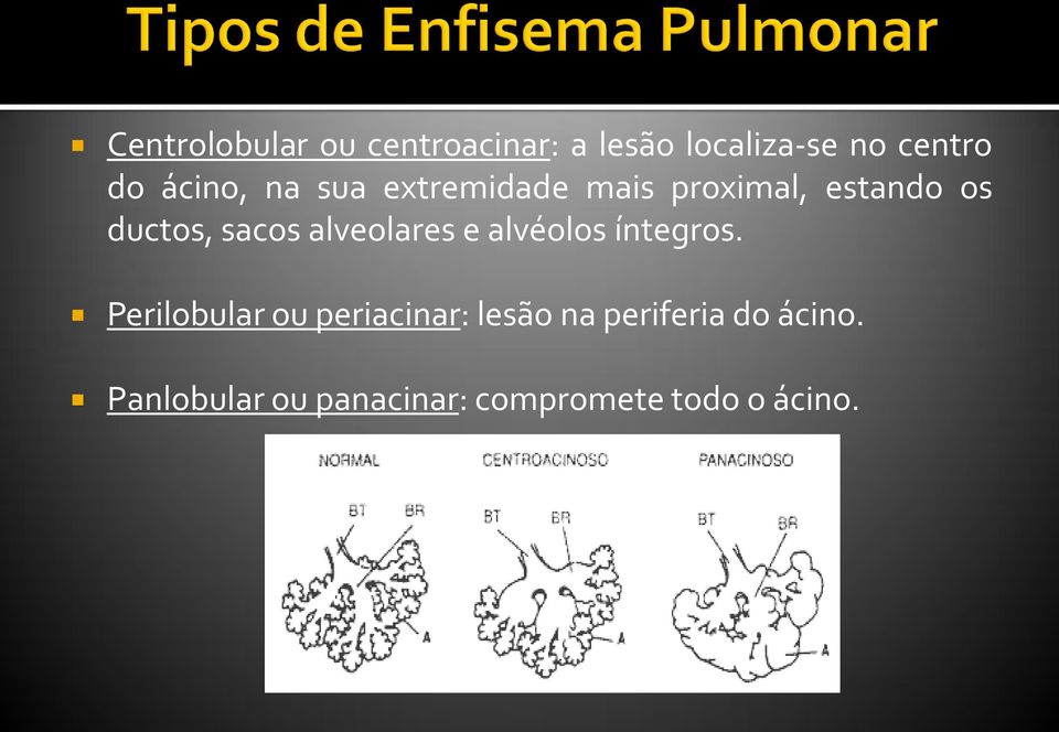 alveolares e alvéolos íntegros.