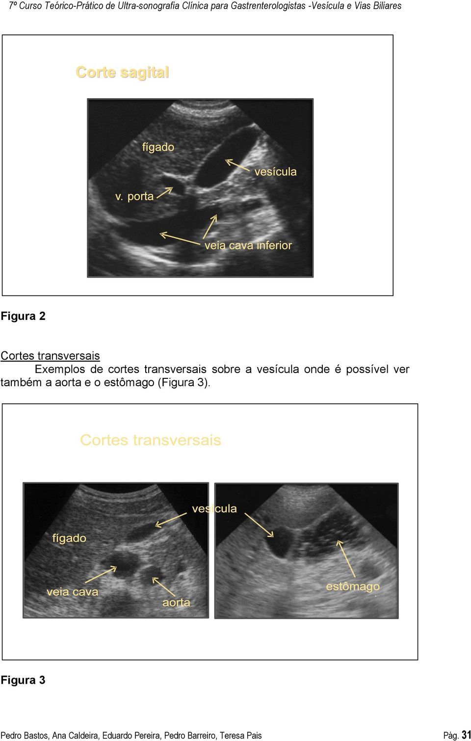 a aorta e o estômago (Figura 3).