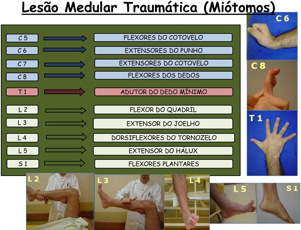 ADUTOR DO DEDO MÍNIMO L 2 L 3 L 4 L 5 S 1 FLEXOR DO QUADRIL EXTENSOR