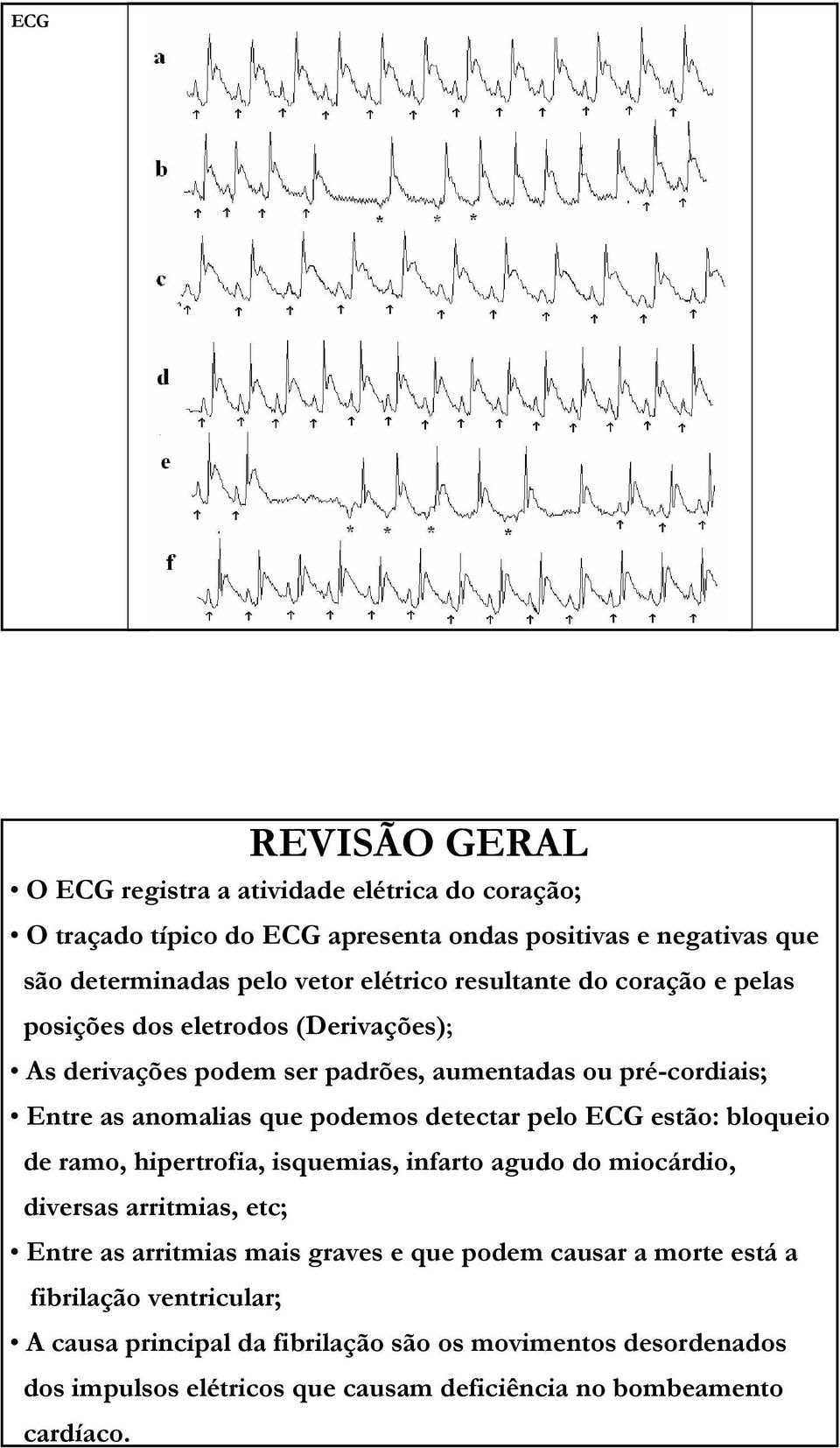 detectar pelo estão: bloqueio de ramo, hipertrofia, isquemias, infarto agudo do miocárdio, diversas arritmias, etc; Entre as arritmias mais graves e que podem