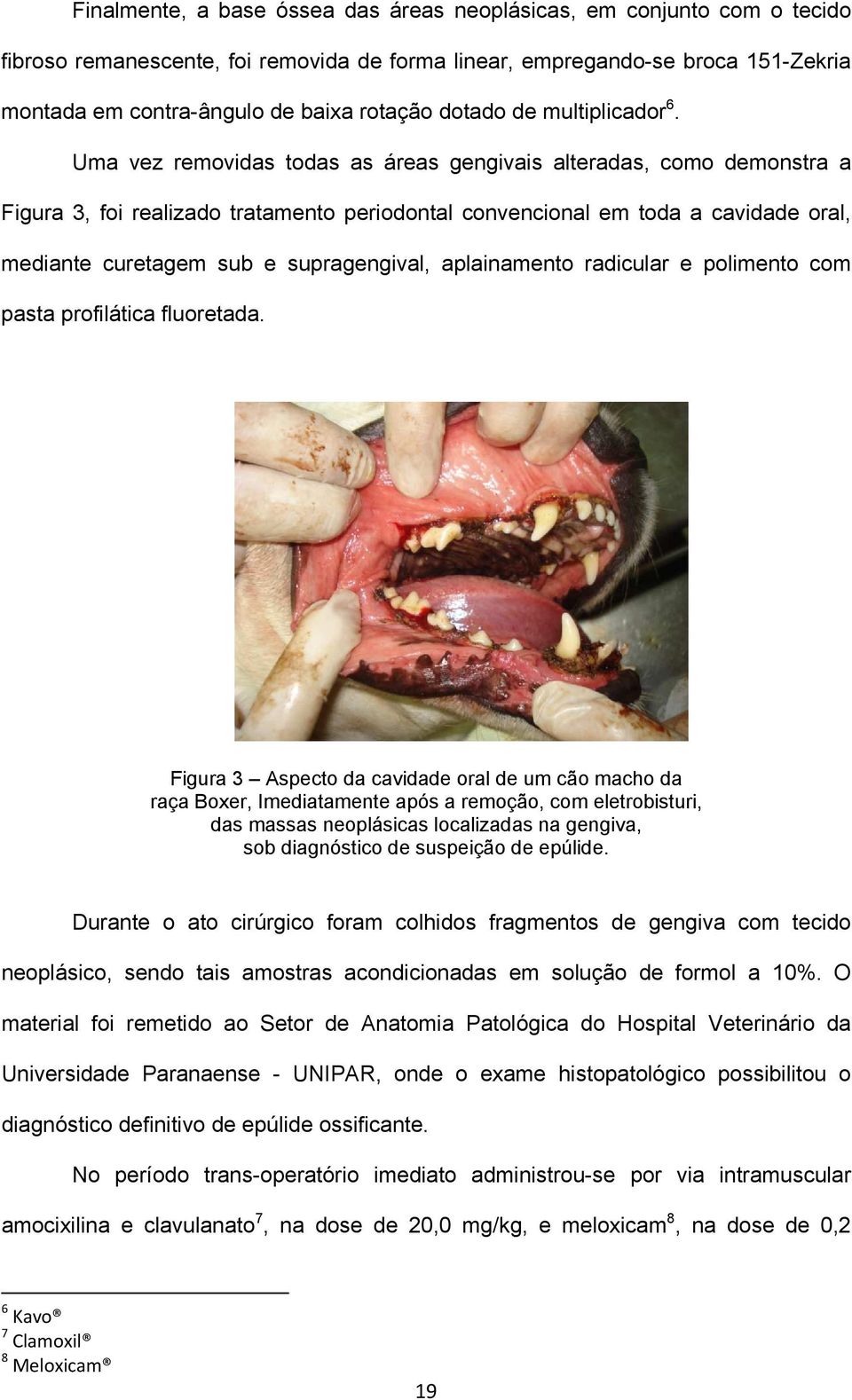 Uma vez removidas todas as áreas gengivais alteradas, como demonstra a Figura 3, foi realizado tratamento periodontal convencional em toda a cavidade oral, mediante curetagem sub e supragengival,