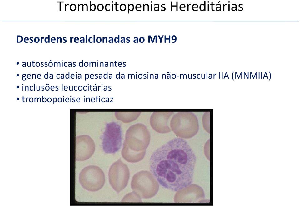 gene da cadeia pesada da miosina não-muscular