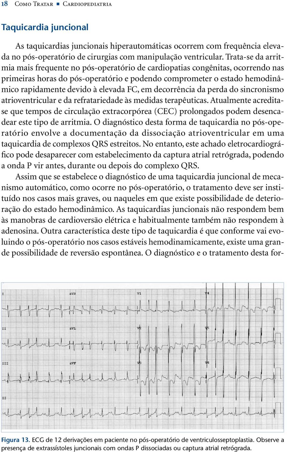 elevada FC, em decorrência da perda do sincronismo atrioventricular e da refratariedade às medidas terapêuticas.