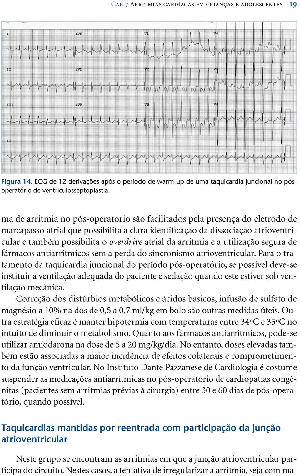 atrial da arritmia e a utilização segura de fármacos antiarrítmicos sem a perda do sincronismo atrioventricular.