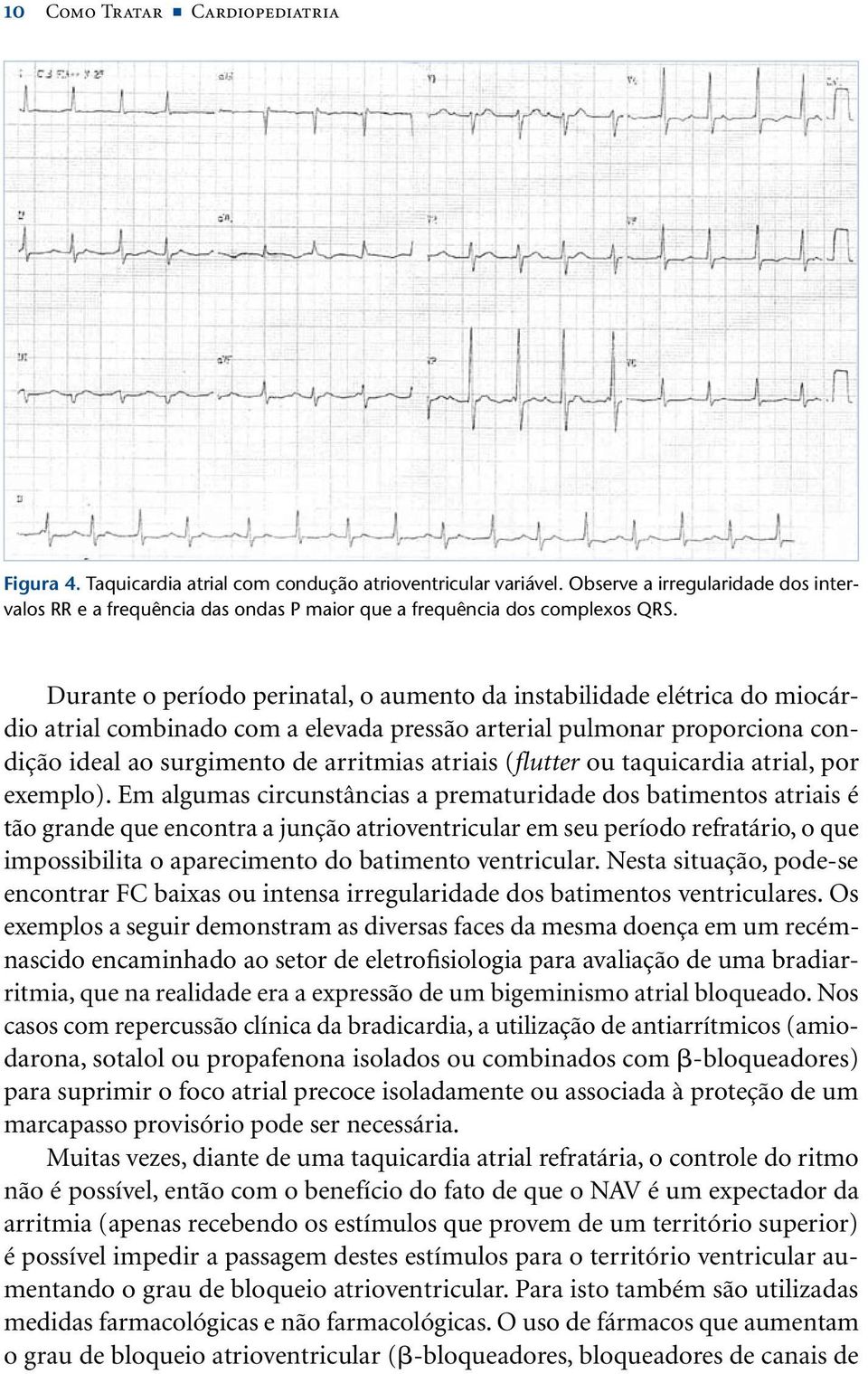 Durante o período perinatal, o aumento da instabilidade elétrica do miocárdio atrial combinado com a elevada pressão arterial pulmonar proporciona condição ideal ao surgimento de arritmias atriais