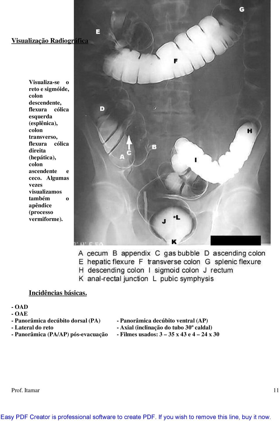 Algumas vezes visualizamos também o apêndice (processo vermiforme). Incidências básicas.