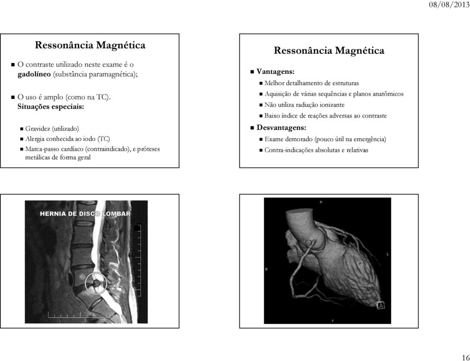 geral Ressonância Magnética Vantagens: Melhor detalhamento de estruturas Aquisição de várias sequências e planos anatômicos Não utiliza