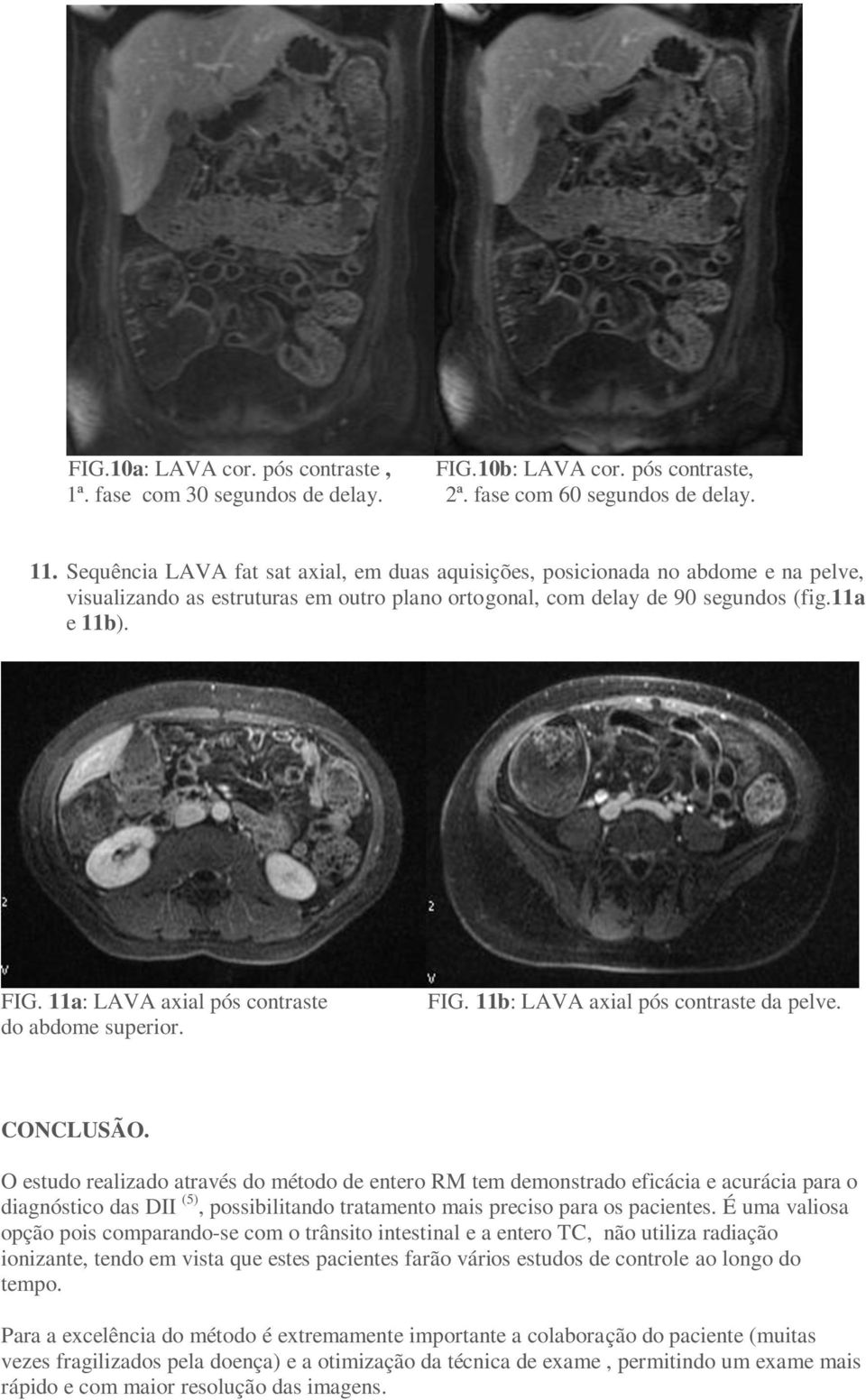 11a: LAVA axial pós contraste do abdome superior. FIG. 11b: LAVA axial pós contraste da pelve. CONCLUSÃO.