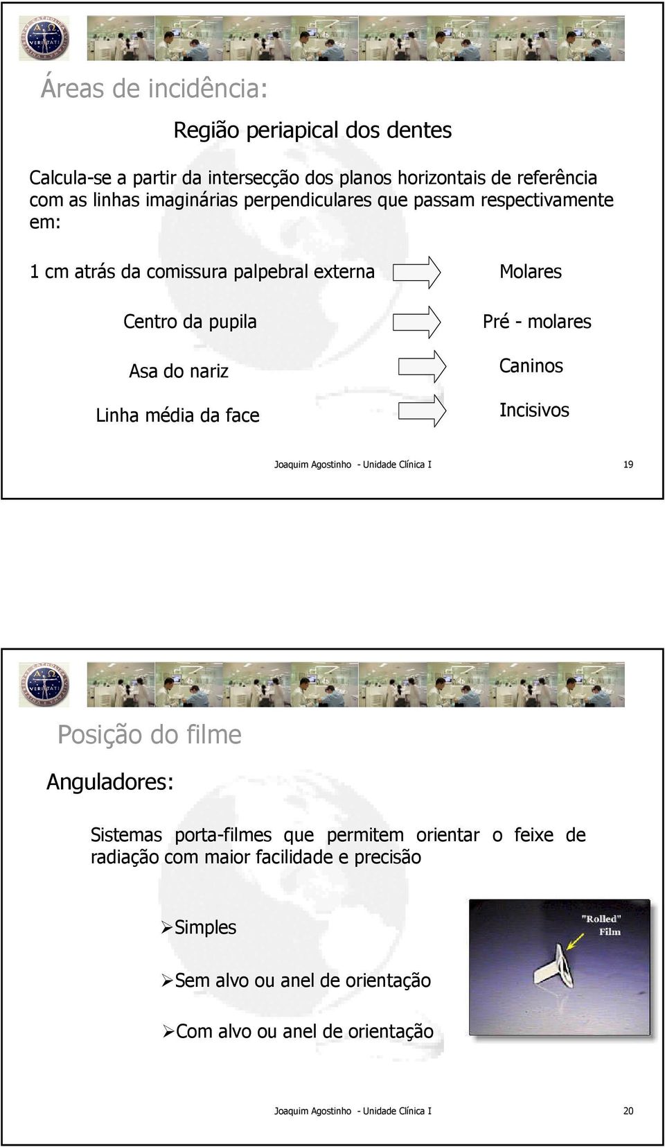 nariz Linha média da face Molares Pré - molares Caninos Incisivos 19 Posição do filme Anguladores: Sistemas porta-filmes que