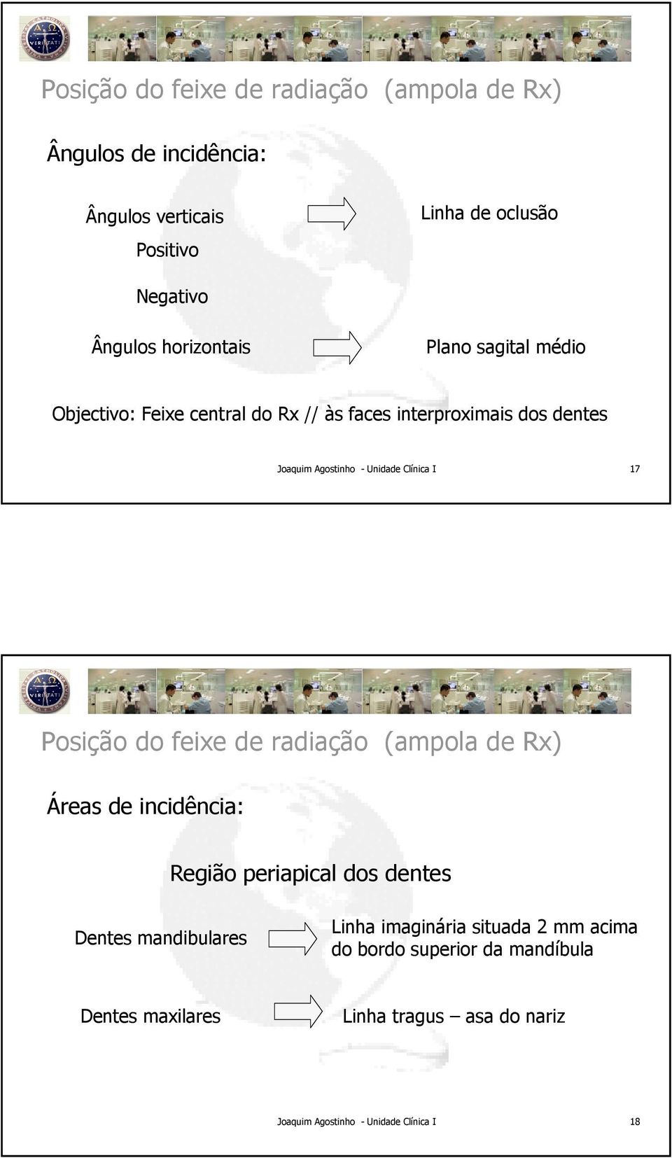 dentes 17 Posição do feixe de radiação (ampola de Rx) Áreas de incidência: Região periapical dos dentes Dentes