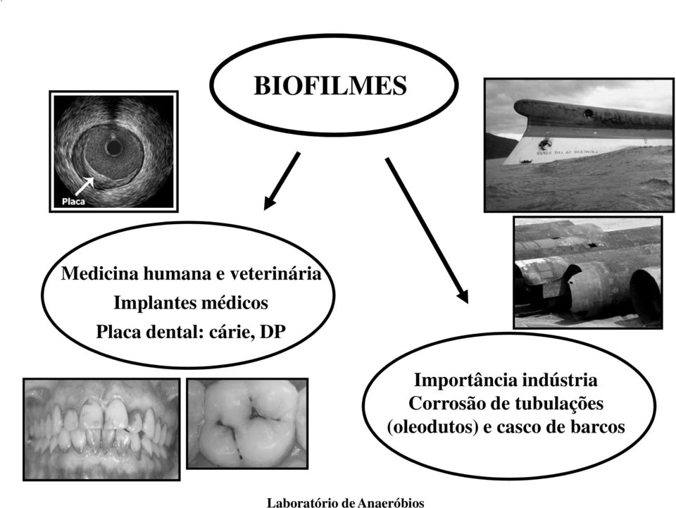 dental: cárie, DP Importância