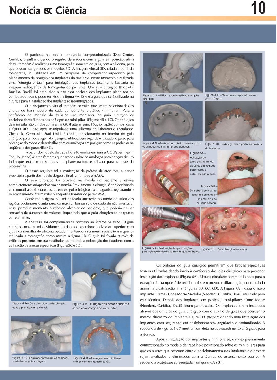 A imagem virtual 3D, criada a partir da tomografia, foi utilizada em um programa de computador específico para planejamento da posição dos implantes do paciente.