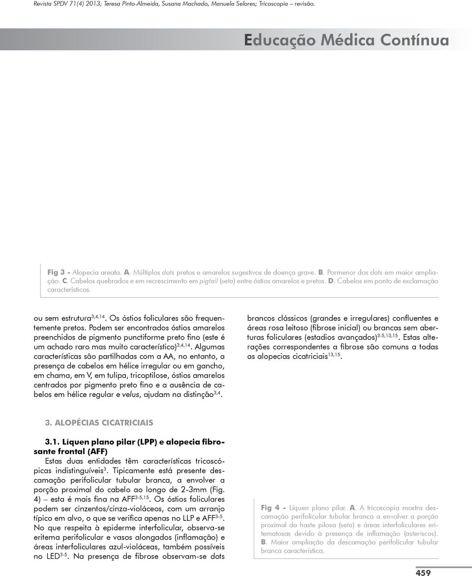 Os óstios foliculares são frequentemente pretos. Podem ser encontrados óstios amarelos preenchidos de pigmento punctiforme preto fino (este é um achado raro mas muito característico) 3,4,14.