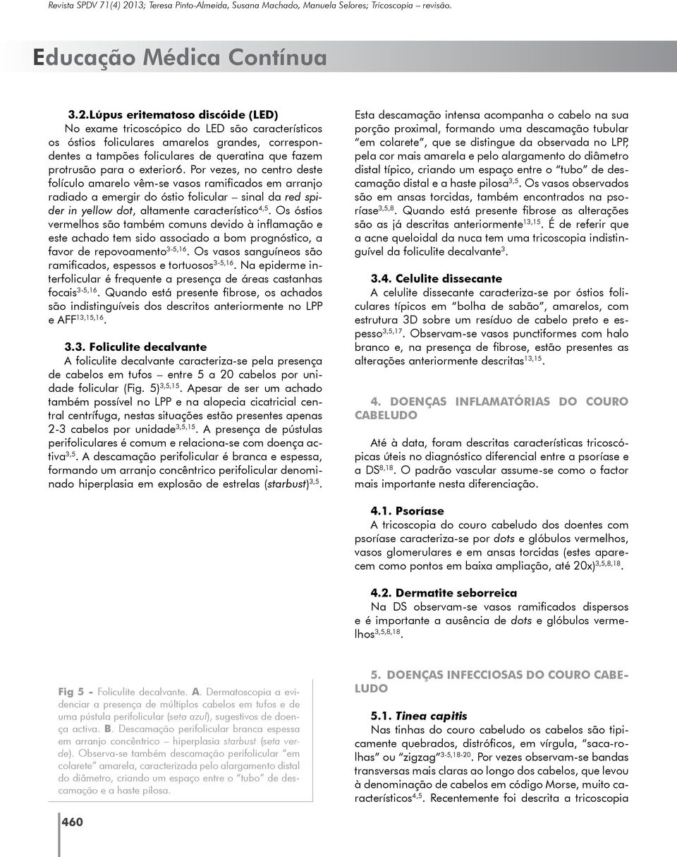 Os óstios vermelhos são também comuns devido à inflamação e este achado tem sido associado a bom prognóstico, a favor de repovoamento 3-5,16.