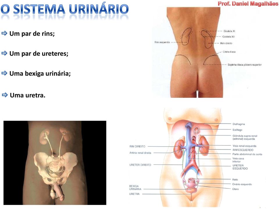 ureteres; Uma