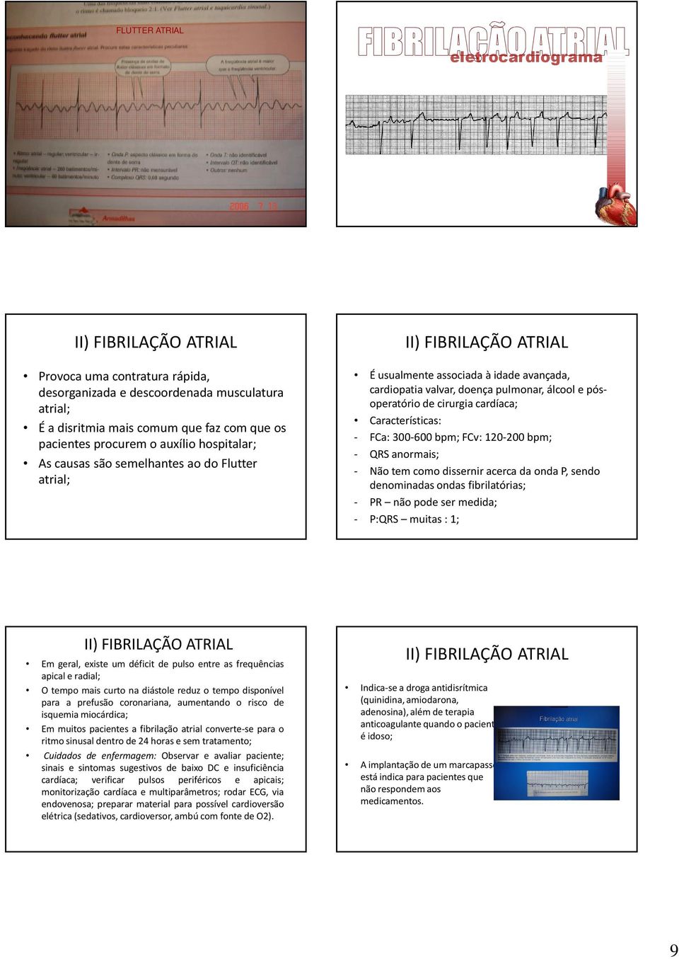 cirurgia cardíaca; Características: - FCa: 300-600 bpm; FCv: 120-200 bpm; - QRS anormais; - Não tem como dissernir acerca da onda P, sendo denominadas ondas fibrilatórias; - PR não pode ser medida; -