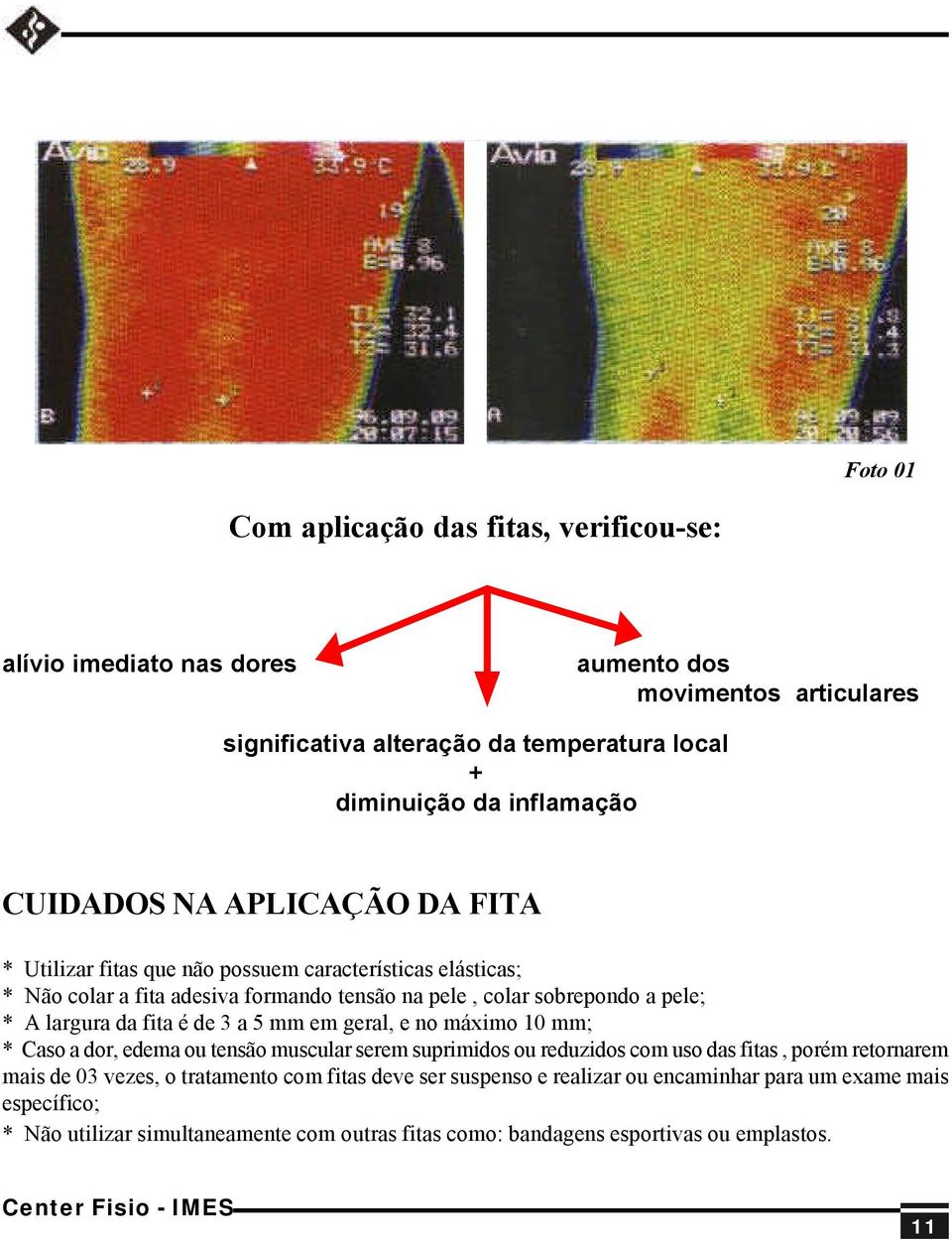 da fita é de 3 a 5 mm em geral, e no máximo 10 mm; * Caso a dor, edema ou tensão muscular serem suprimidos ou reduzidos com uso das fitas, porém retornarem mais de 03 vezes, o