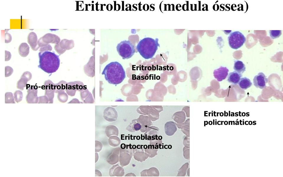 Basófilo Eritroblastos