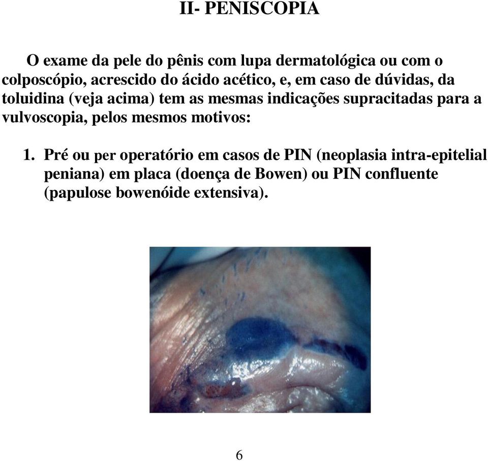 supracitadas para a vulvoscopia, pelos mesmos motivos: 1.