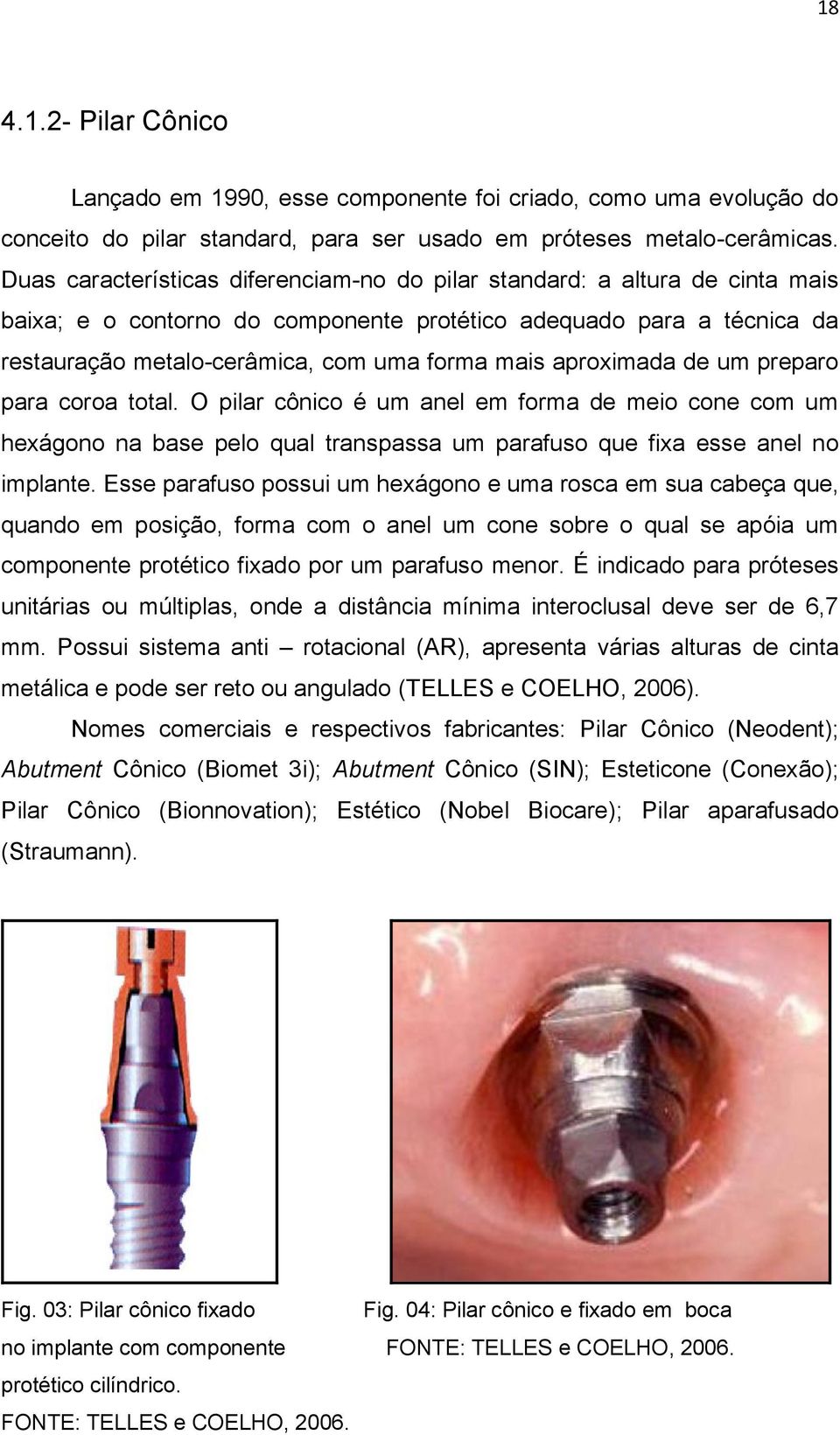 aproximada de um preparo para coroa total. O pilar cônico é um anel em forma de meio cone com um hexágono na base pelo qual transpassa um parafuso que fixa esse anel no implante.