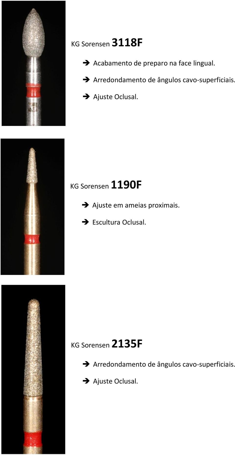 KG Sorensen 1190F Ajuste em ameias proximais. Escultura Oclusal.