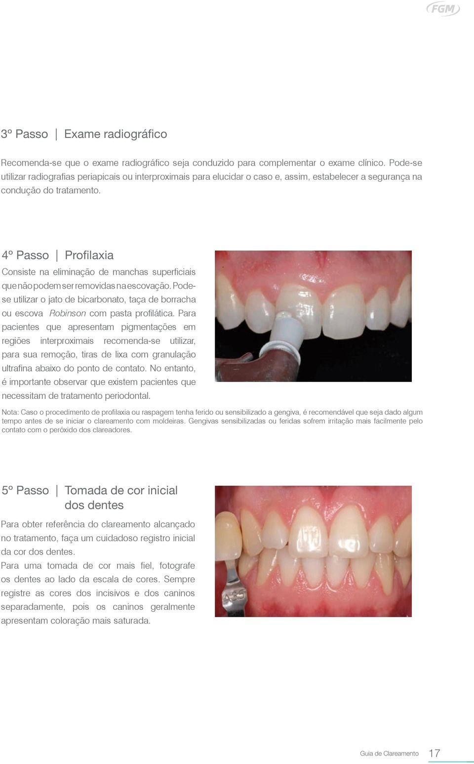 4º Passo Profilaxia Consiste na eliminação de manchas superficiais que não podem ser removidas na escovação.