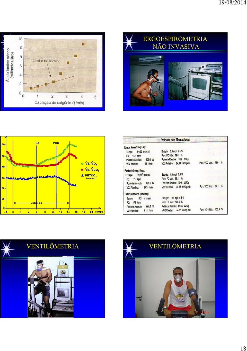 . VE/ VCO 2 35 - PETCO 2 (mmhg) 30-25 -