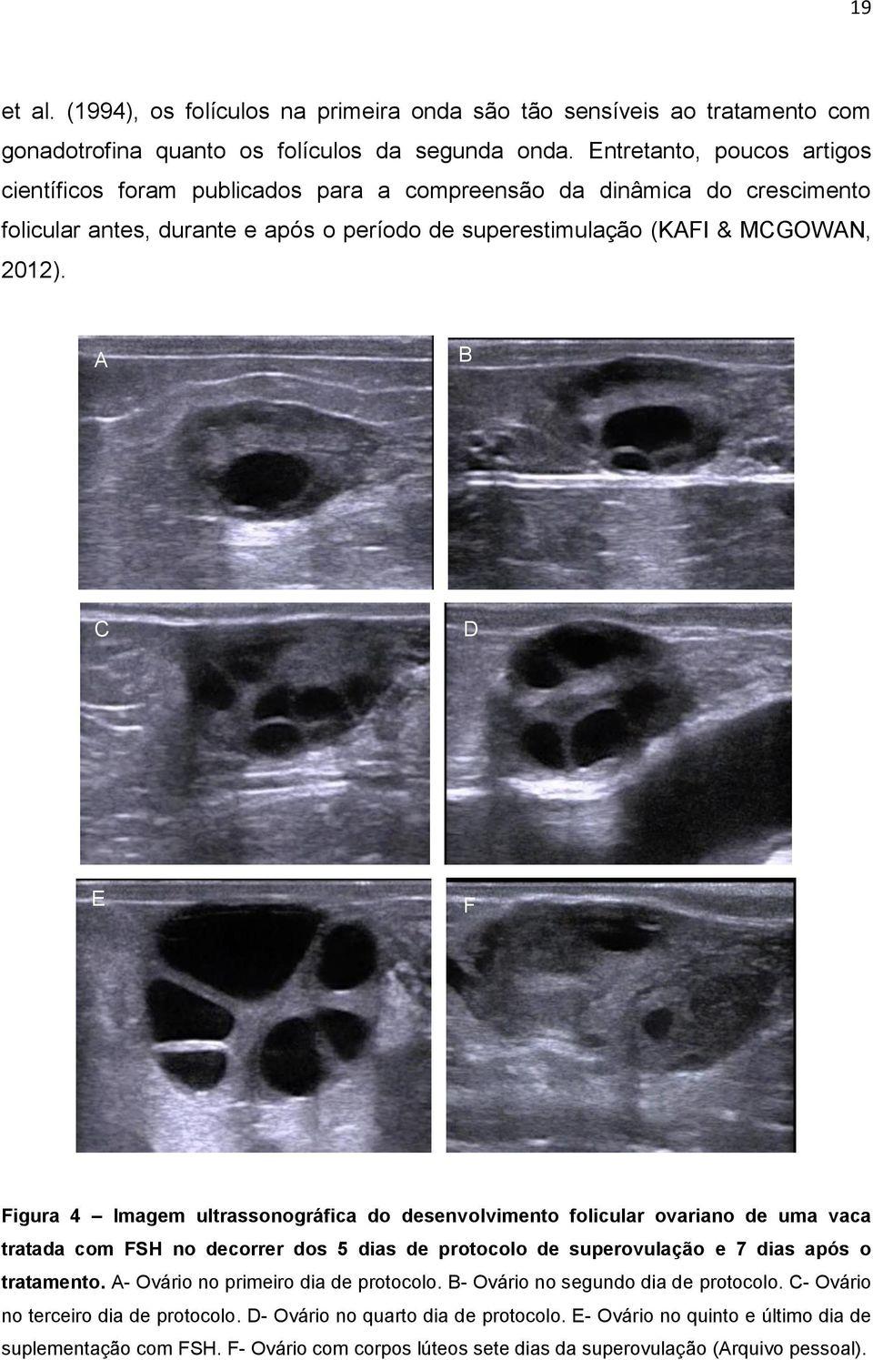 A B C D E F Figura 4 Imagem ultrassonográfica do desenvolvimento folicular ovariano de uma vaca tratada com FSH no decorrer dos 5 dias de protocolo de superovulação e 7 dias após o tratamento.