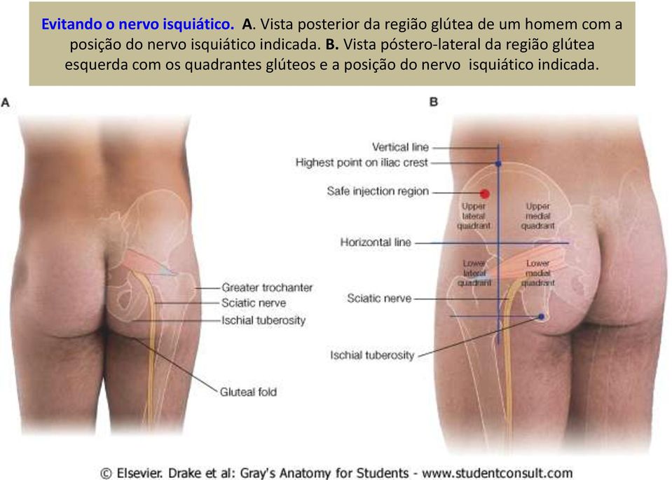 do nervo isquiático indicada. B.