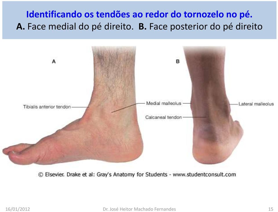 Face medial do pé direito. B.